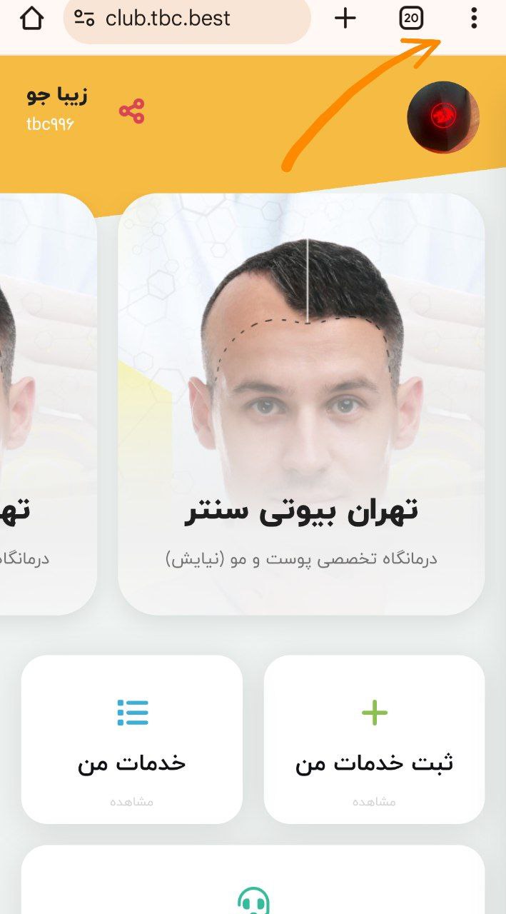 مرحله ۲